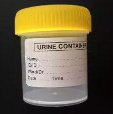 CAD/UGの注文の医学の注入型の尿のコレクター型OEM